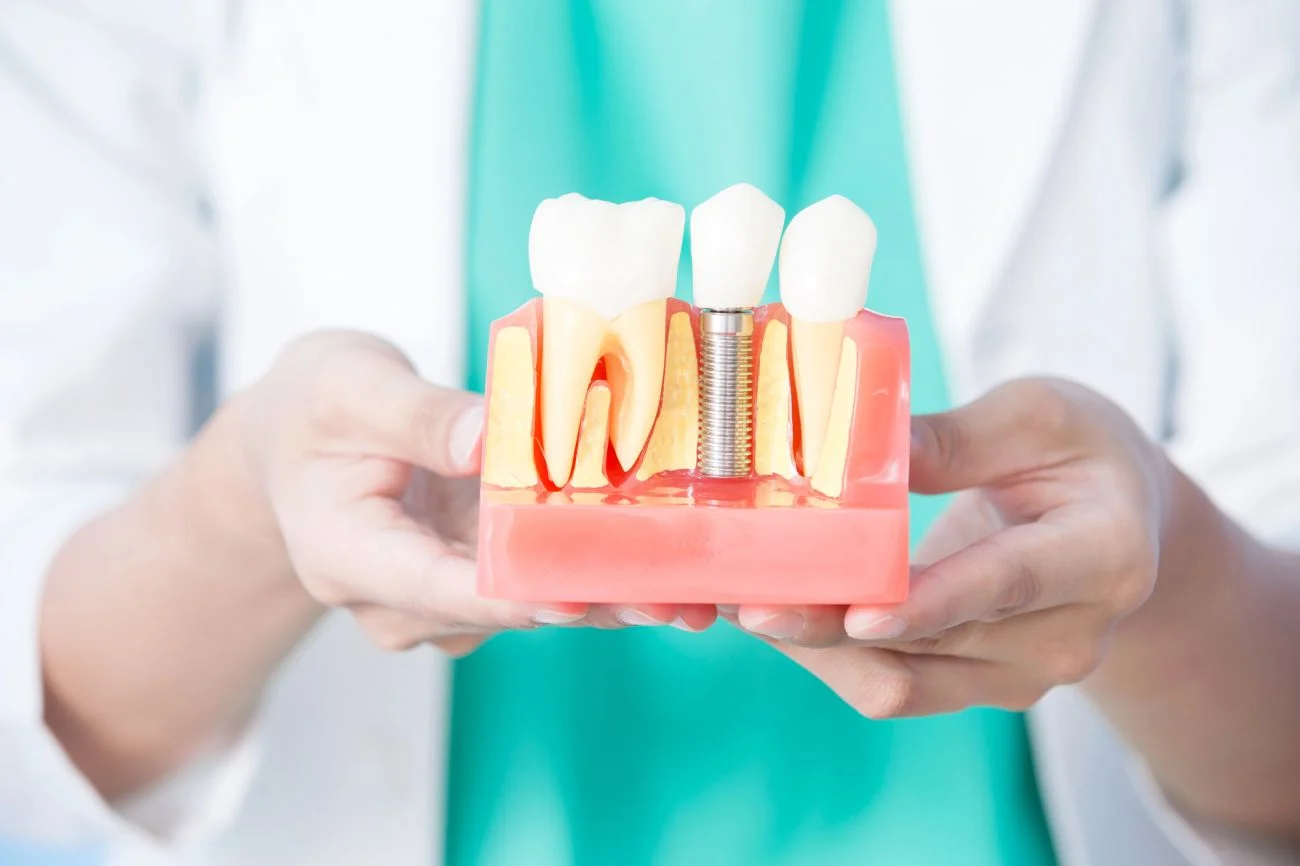 Dlaczego implanty zębowe to inwestycja w zdrowie i pewność siebie?